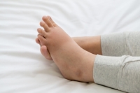 Why Does Foot Swelling Occur During Pregnancy?