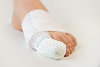 Causes and Treatments for Broken Toes