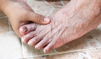 Common Causes of Toenail Fungus